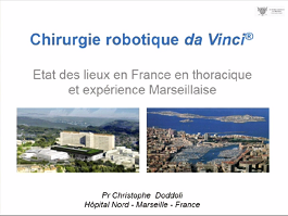 Développement de la Chirurgie thoracique robotique en France: état des lieux et expérience Marseillaise.