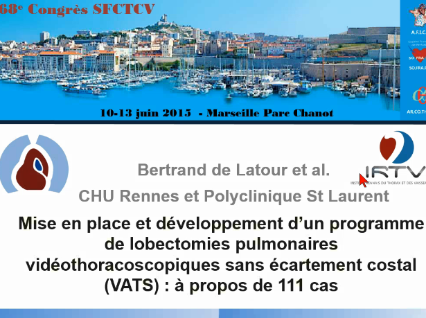 Mise en place et développement d'un programme de lobectomies pulmonaires vidothoracoscopiques Mise en place et développement d'un programme de lobectomies pulmonaires vidothoracoscopiques