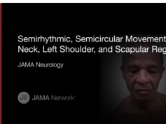 Dancing Dorsal Quadrilaterals Syndrome (Case 1) Dancing Dorsal Quadrilaterals Syndrome (Case 1)