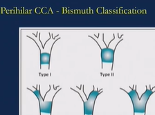 Day 1 - Management of Biliary Obstruction Day 1 - Management of Biliary Obstruction