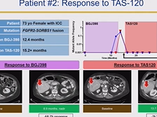 Day 2 - FGFR Inhibition Day 2 - FGFR Inhibition