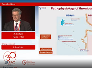 De l'ESA à la cardiomyopathie atriale : un continuum