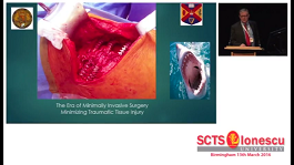 Debate: Rib Fractures - there is no need for metallic corsets