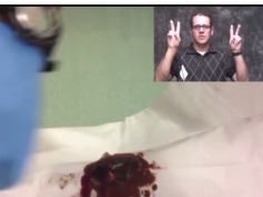 Deep Abscess - version 2 (a remake of the older video)