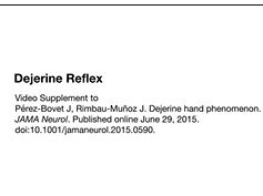 Dejerine Reflex Dejerine Reflex