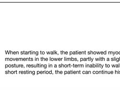 Demonstration of Kinesigenic Dyskinesia Demonstration of Kinesigenic Dyskinesia