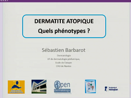 Dermatite atopique : Quels phénotypes?