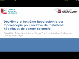 Deuxième et troisième hépatectomie par laparoscopie pour récidive de métastases hépatiques de cancer colorectal