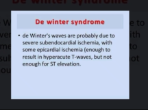 Dewintersyndrome on ECG overview