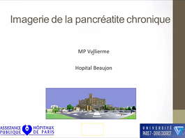 Diagnostic d'une pancréatite chronique par imagerie