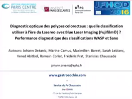 Diagnostic optique des polypes colorectaux : quelle classification utiliser à l'ère du Lasereo avec Blue Laser Imaging ? Performance diagnostique des classifications WASP et Sano