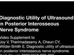 Diagnostic Utility of Ultrasound in Posterior Interosseous Nerve Syndrome Diagnostic Utility of Ultrasound in Posterior Interosseous Nerve Syndrome
