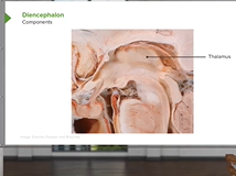 Diencephalon: Components & Structure - Brain & Nervous System Diencephalon: Components & Structure - Brain & Nervous System