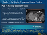 Difficult PEG: Preop Evaluation and Technique in Patients