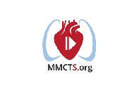 Direct aortic transcatheter valve implantation via mini-thoracotomy using CoreValve Direct aortic transcatheter valve implantation via mini-thoracotomy using CoreValve