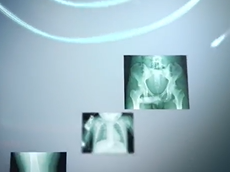 Discovery XR 656 HD, Powered by Helix advanced image processing