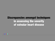 Discrepancies amongst techniques in assessing the severity of valvular heart disease Discrepancies amongst techniques in assessing the severity of valvular heart disease