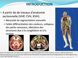 Dissection virtuelle à partir d`acquisitions de scanner surfacique