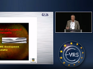 DME Progression After Cataract Surgery