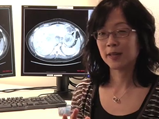 Doing More with Less: Radiation Doses Dropping - Mayo Clinic