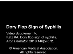 Dory Flop Sign of Syphilis