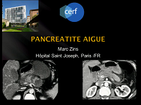 Douleur épigastrique : pancréatite et classification (Syndrome occlusif )