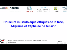Douleurs musculo-squelettiques de la face, Migraine et Céphalée de tension Douleurs musculo-squelettiques de la face, Migraine et Céphalée de tension