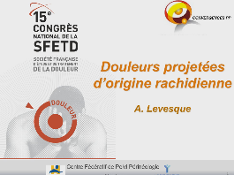 Douleurs projetées d'origine rachidienne