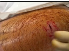 Dr. ER's Poppy Popping Popaholic Channel