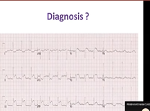 Dr Prabhavathi ECG Discussion 25th June 2020 10am