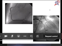 Dr Raghavan Interactive Cases and Hemodynamics Part 4 20th June 2020