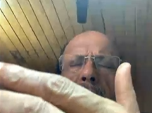 Dr RJM Clinical Case Discussion Dr Pragathi 7th June 2020 HFR