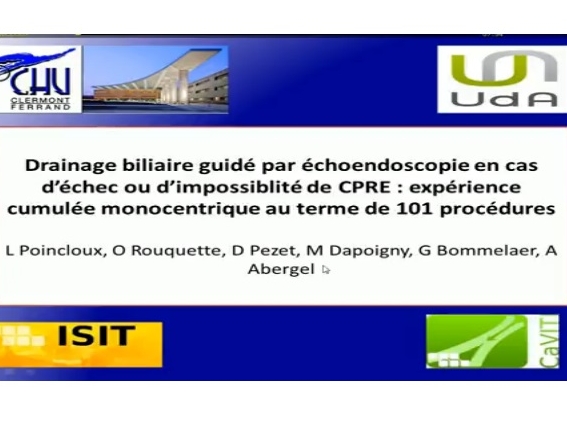 Drainage biliaire guidé par échoendoscopie en cas d’échec ou d’impossiblité de CPRE : expérience cumulée monocentrique au terme de 101 procédures