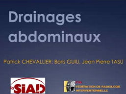 Drainages abdominaux Drainages abdominaux