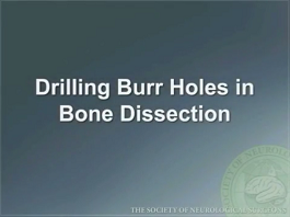 Drilling Burr Holes in Bone Dissection