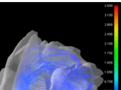 Dynamic Streamline Simulation of Nasal Flow Part 2