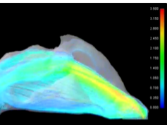 Dynamic Streamline Simulation of Nasal Flow Part 3