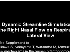 Dynamic Streamline Simulation of Nasal Flow Part 4