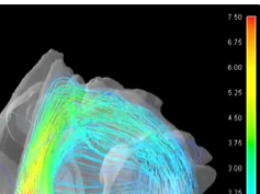 Dynamic Streamline Simulation of Nasal Flow Part 5