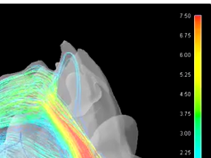 Dynamic Streamline Simulation of Nasal Flow Part 6