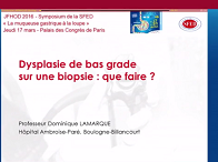 Dysplasie de bas grade sur une biopsie : que faire ?