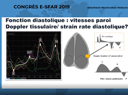 e-sfar 2019 -L'échographie : jusqu'où ?