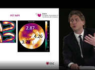 EACVI free webinar: Current practice and state of the art in coronary flow measurements EACVI free webinar: Current practice and state of the art in coronary flow measurements
