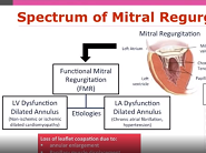 EACVI free webinar: How to use TOE for interventional procedures: tips and tricks EACVI free webinar: How to use TOE for interventional procedures: tips and tricks