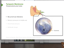 Ear Anatomy: Ear Ossicles- Brain & Nervous System Ear Anatomy: Ear Ossicles- Brain & Nervous System