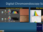 Early Detection of Esophageal Cancer and Barretts Esophagus