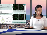 EASD 2019 Samaneh Yazdanikivi