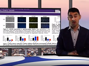 EASD 2019 Saumik Biswas