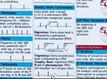 ECG summary