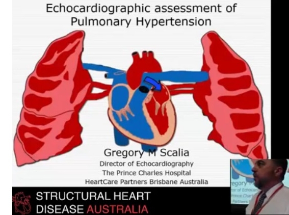 Echocardiographic assessment of pulmonary hypertension